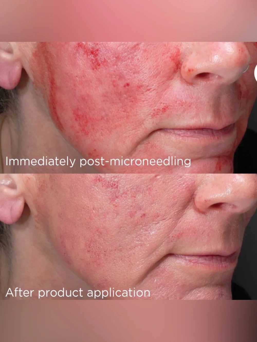 ✨New✨ Image DAILY PREVENTION advanced smartblend mineral moisturizer SPF 75